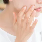 ニキビ